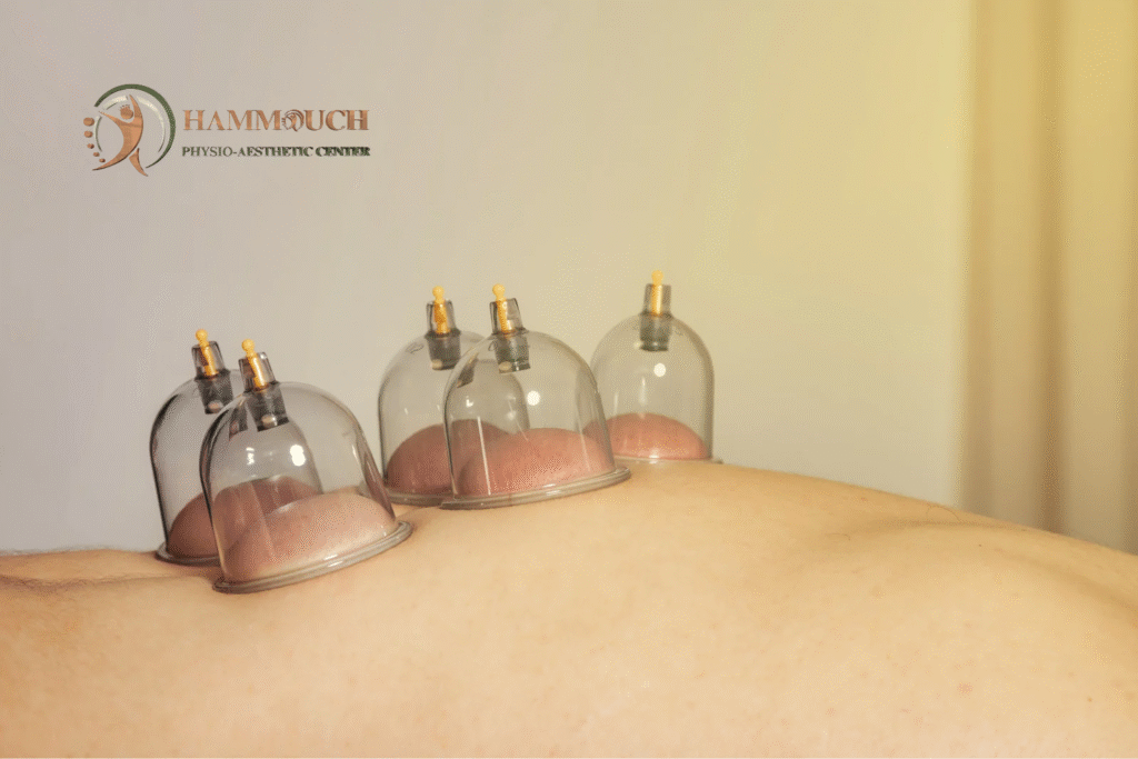 Séance de hijama à Fès au Hammouch Center avec application de ventouses sur le dos pour soulager les tensions et améliorer la circulation.